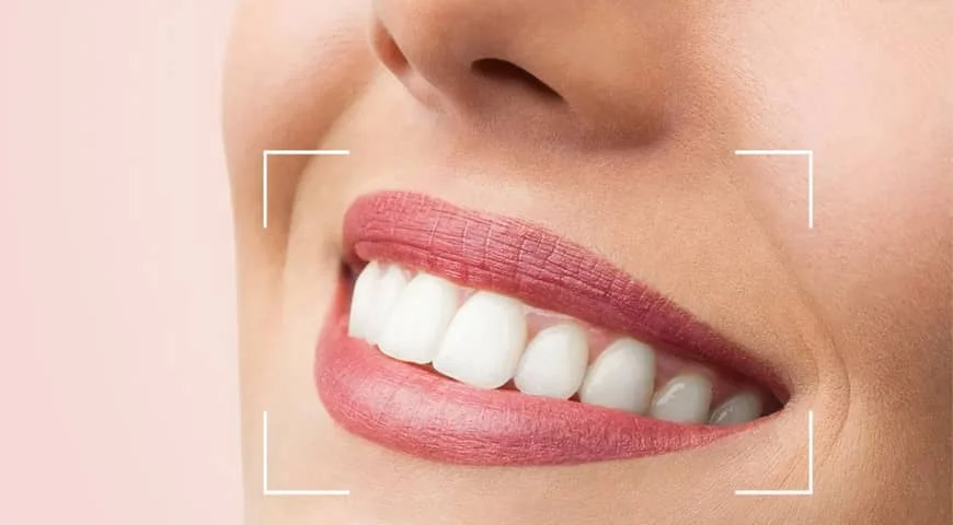 Best Smile makeover clinic in Sector 16, Faridabad