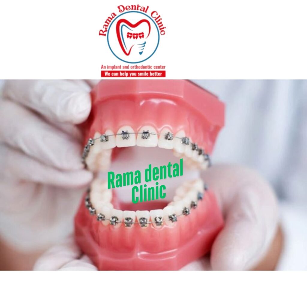 Best Braces Specialist in Palwal