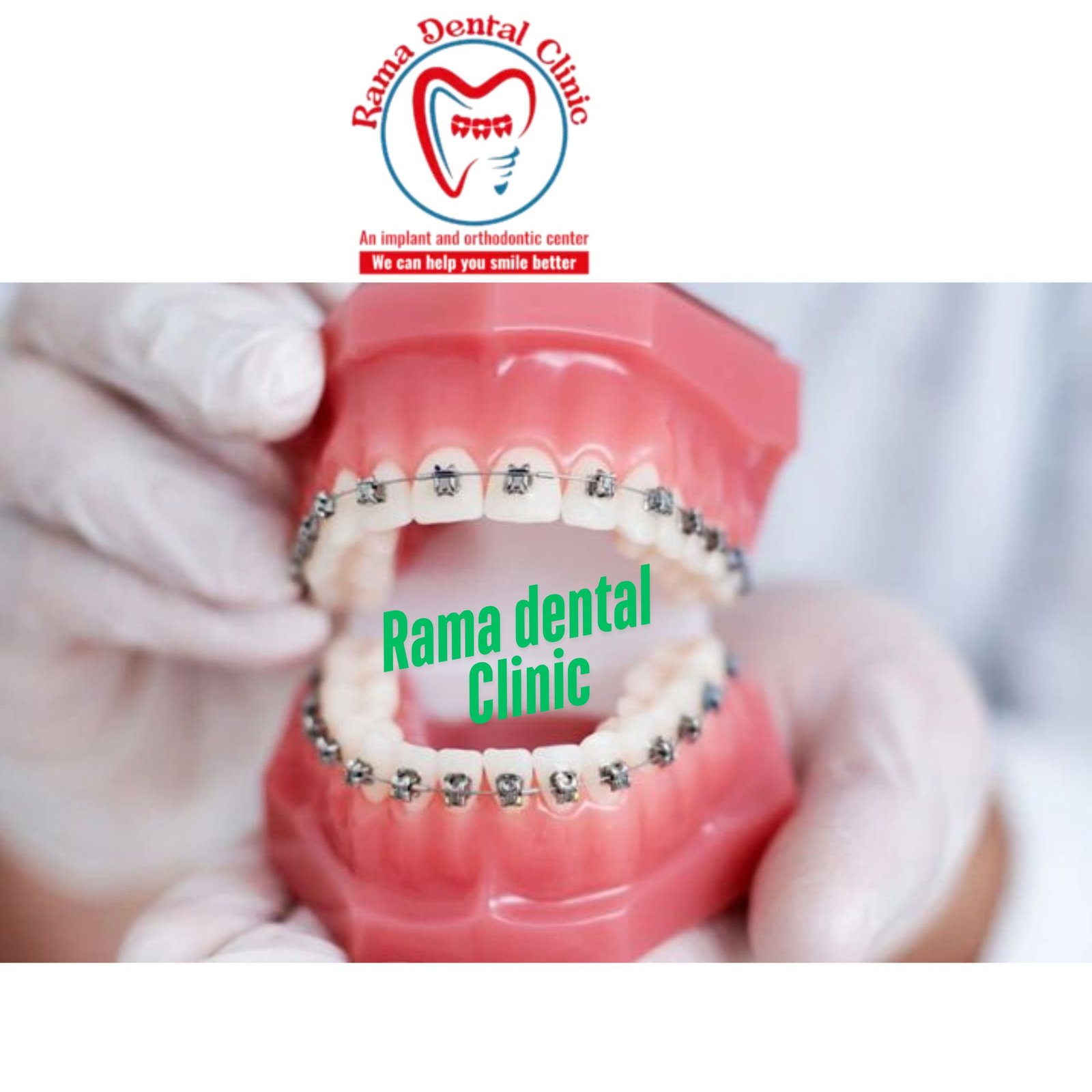 Best Braces Specialist in Palwal