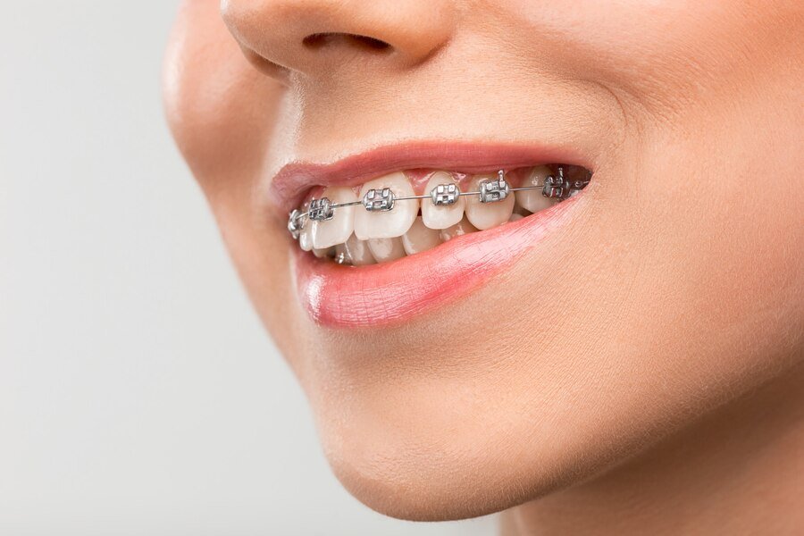 Orthodontic Centre in Palwal