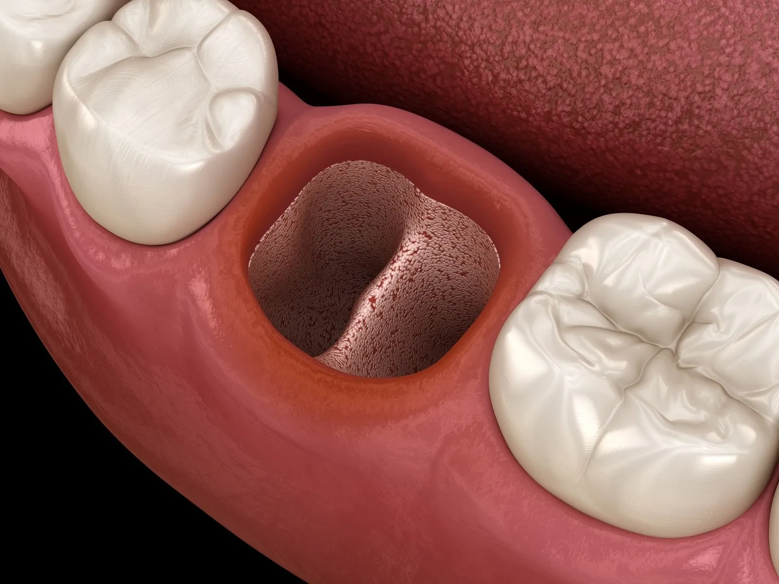 Best Orthodontist in Sector 16 Faridabad