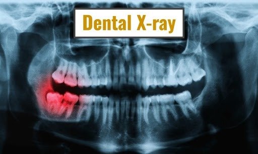 Best Dental care Clinic in Faridabad