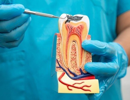 Best Root Canal Treatment in Sector 16, Faridabad